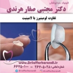 تفاوت لومینیرز با لامینیت