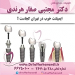 ایمپلنت خوب در تهران کجاست ؟