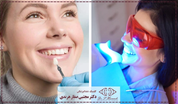 بلیچینگ و لمینت دندان