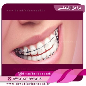 ارتودنسی-دندان
