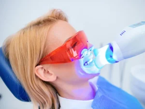 هزینه بلیچینگ دندان