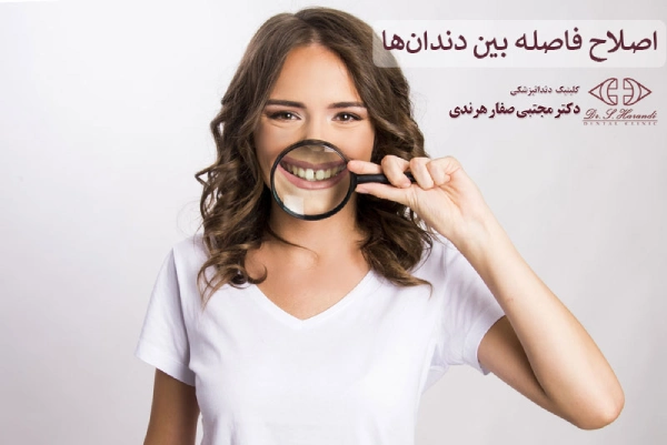 فاصله بین دندانها