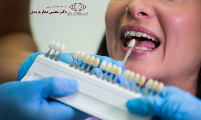 کاربردهای لمنیت دندان