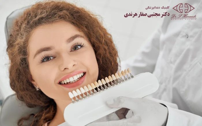 مزایا لمینت دندان