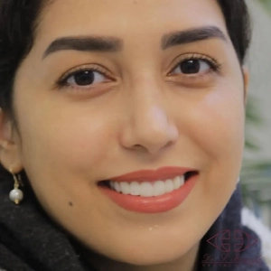 کامپوزیت دندان