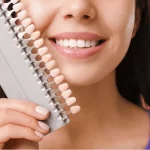 قیمت لمینت دندان در سال 1404