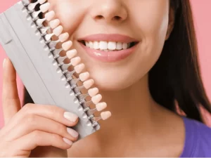 قیمت لمینت دندان در سال 1404