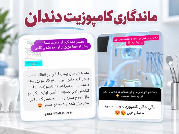 ماندگاری کامپوزیت دندان