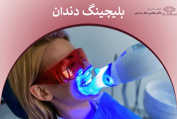 بلیچینگ دندان