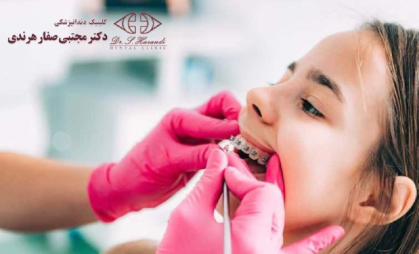جرم گیری دندان بعد از ارتودنسی