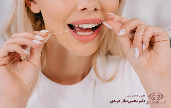 جلوگیری از زرد شدن کامپوزیت دندان
