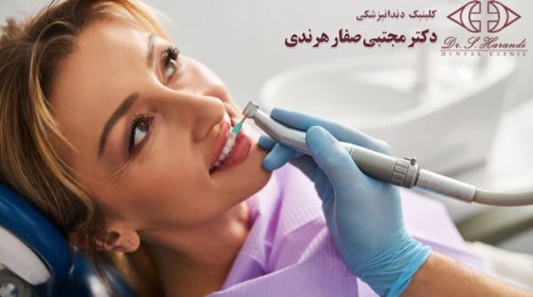 مراحل پالیش کامپوزیت