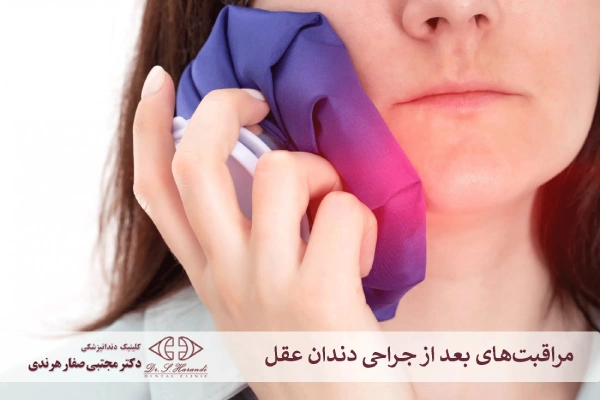 مراقبتهای بعد از جراحی دندان عقل