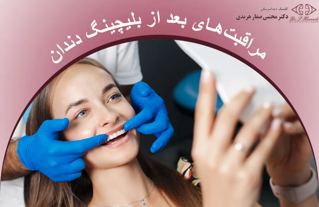 مراقبتهای بعد از بلیچینگ دندان