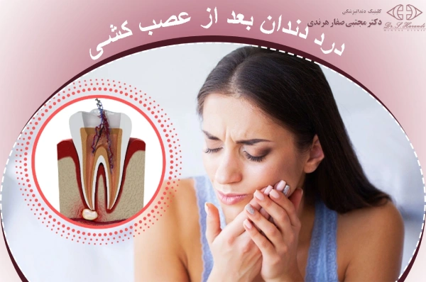 درد دندان بعد از عصب کشی درد دندان بعد از عصب کشی