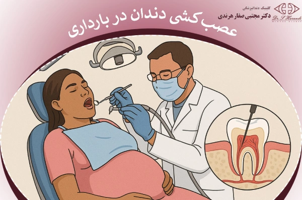 عصبکشی دندان در بارداری