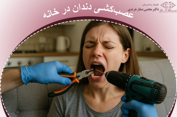 عصبکشی دندان در خانه