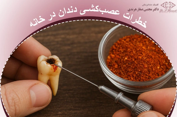 خطرات جدی عصبکشی دندان در خانه