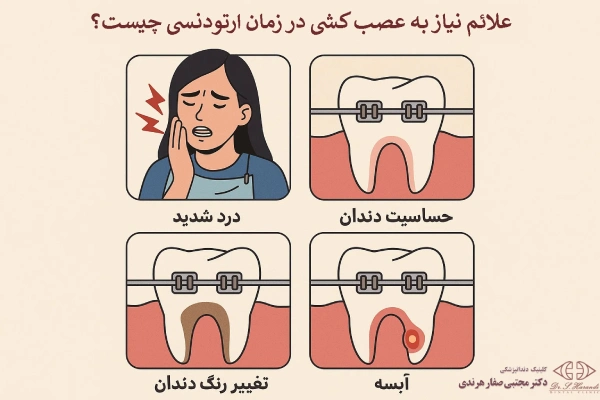 علائم نیاز به عصب کشی در زمان ارتودنسی چیست؟