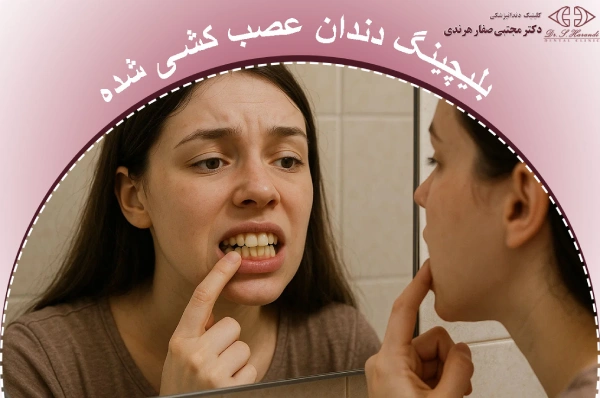 بلیچینگ دندان عصب کشی شده