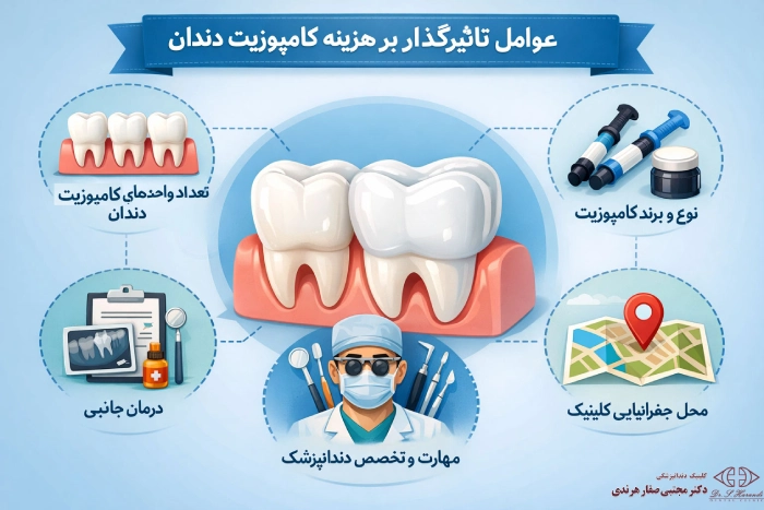 عوامل موثر هزینه کامپوزیت دندان