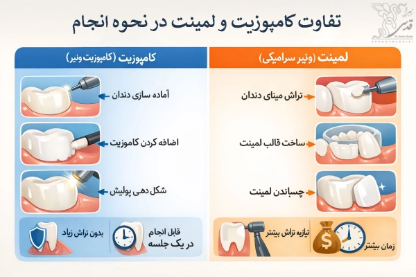 نحوه انجام کامپوزیت و لمینت