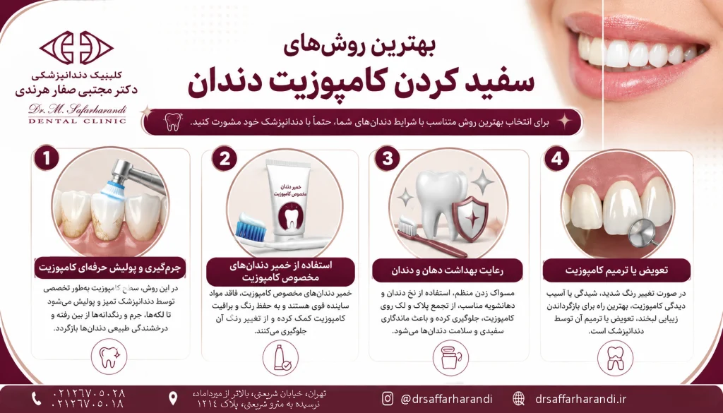 بهترین روشهای سفید کردن کامپوزیت دندان