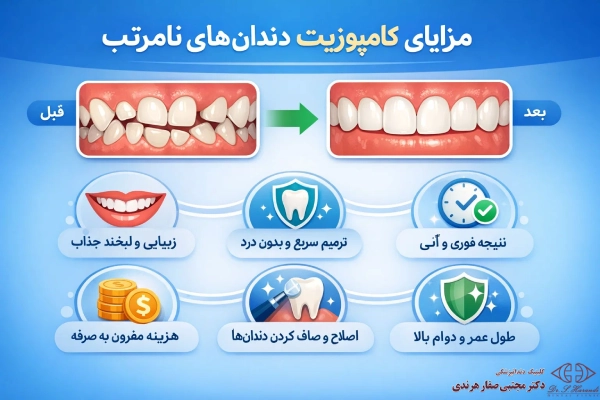 مزایای کامپوزیت دندانهای نامرتب