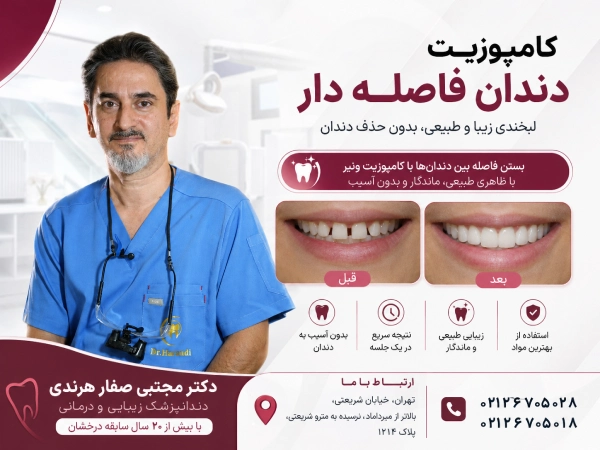 دکتر صفارهرندی برای کامپوزیت دندان فاصله دار