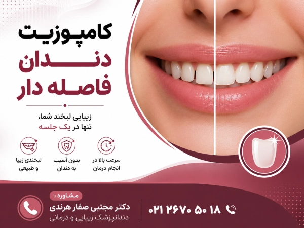 کامپوزیت دندان فاصله دار